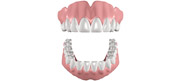 Denture and Implant Dentist Carshalton Beeches, Dental Implants Carshalton Beeches, Complete Dentures Surrey, Carshalton Beeches Denture and Implant Dentist