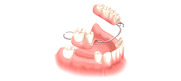 Denture and Implant Dentist Carshalton Beeches, Dental Implants Carshalton Beeches, Complete Dentures Surrey, Carshalton Beeches Denture and Implant Dentist