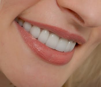 What procedure is done for patients in Carshalton having partial dentures made?