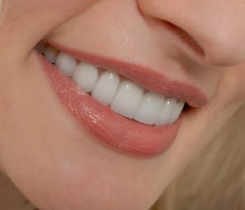 partial denture procedure in carshalton