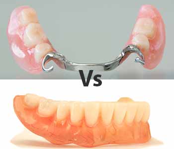The difference in acrylic (plastic) vs. metal (Cobalt Chrome) dentures