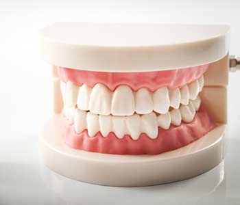 Missing All Your Teeth? Some Full Mouth Solutions To Replace Missing Teeth