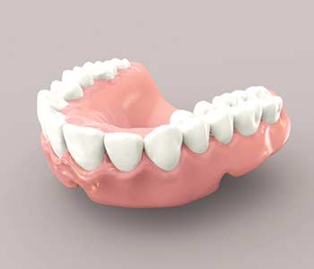 3D Dentures Replace Missing Teeth With Great Results