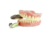 The real damage bad-fitting dentures are doing to you | The Denture ...