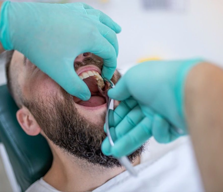 Tooth extraction UK Tooth extraction UK