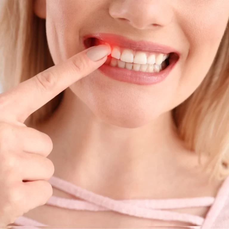 Can Dentures Be Fitted To Receding Gums Can Dentures Be Fitted To Receding Gums