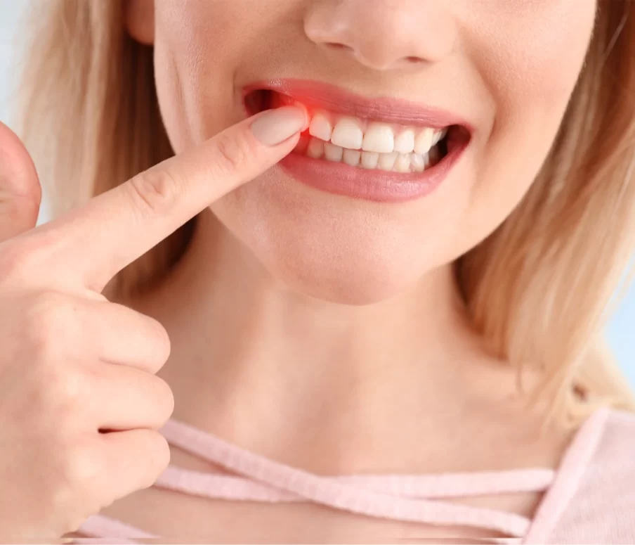 Can Dentures Be Fitted To Receding Gums