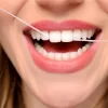 How Often Should You Floss