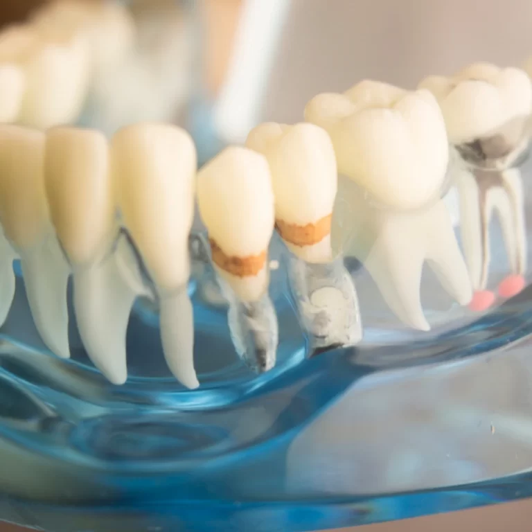 How To Remove Plaque From Dentures How To Remove Plaque From Dentures