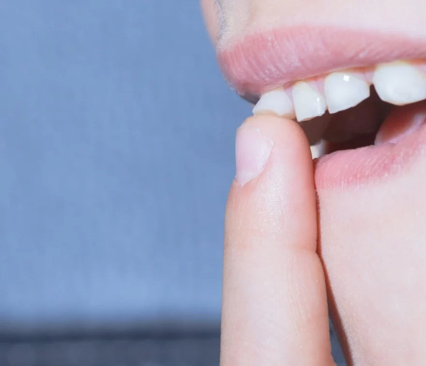 My Front Tooth is Loose