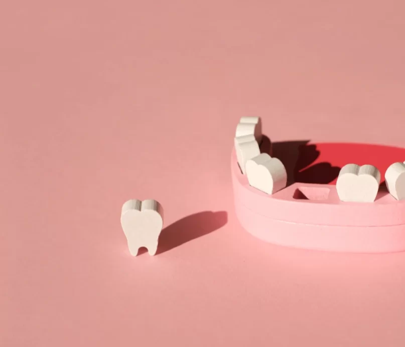 What Are the Options to Replace a Missing Tooth